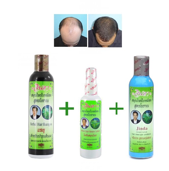 Набор против выпадения волос Шампунь + Кондиционер + Спрей-сыворотка Jinda herbal